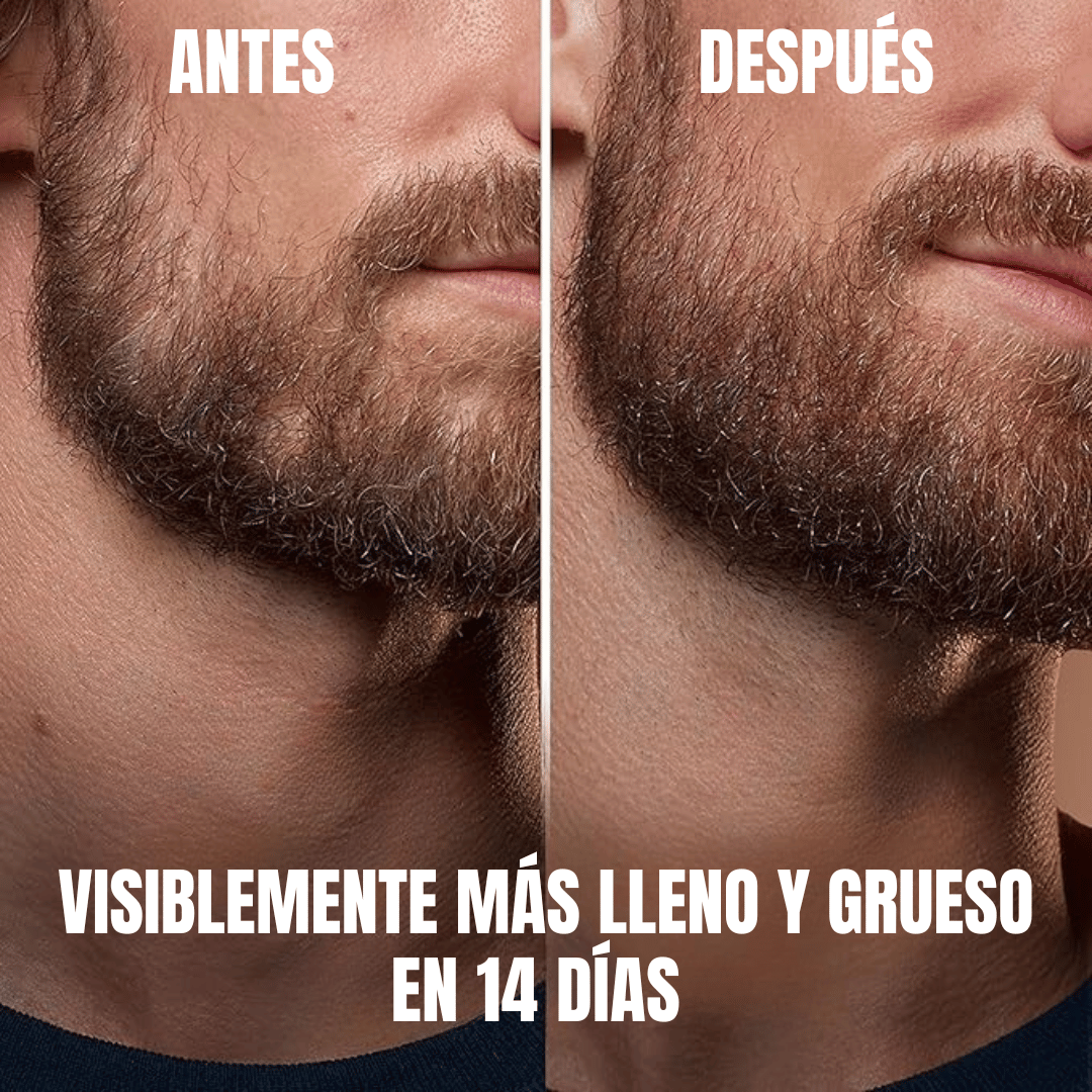 Sérum Engrosador De Barba