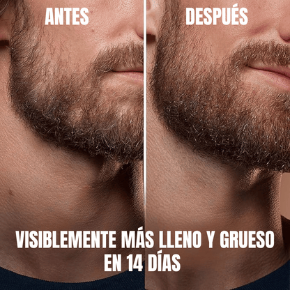 Sérum Engrosador De Barba