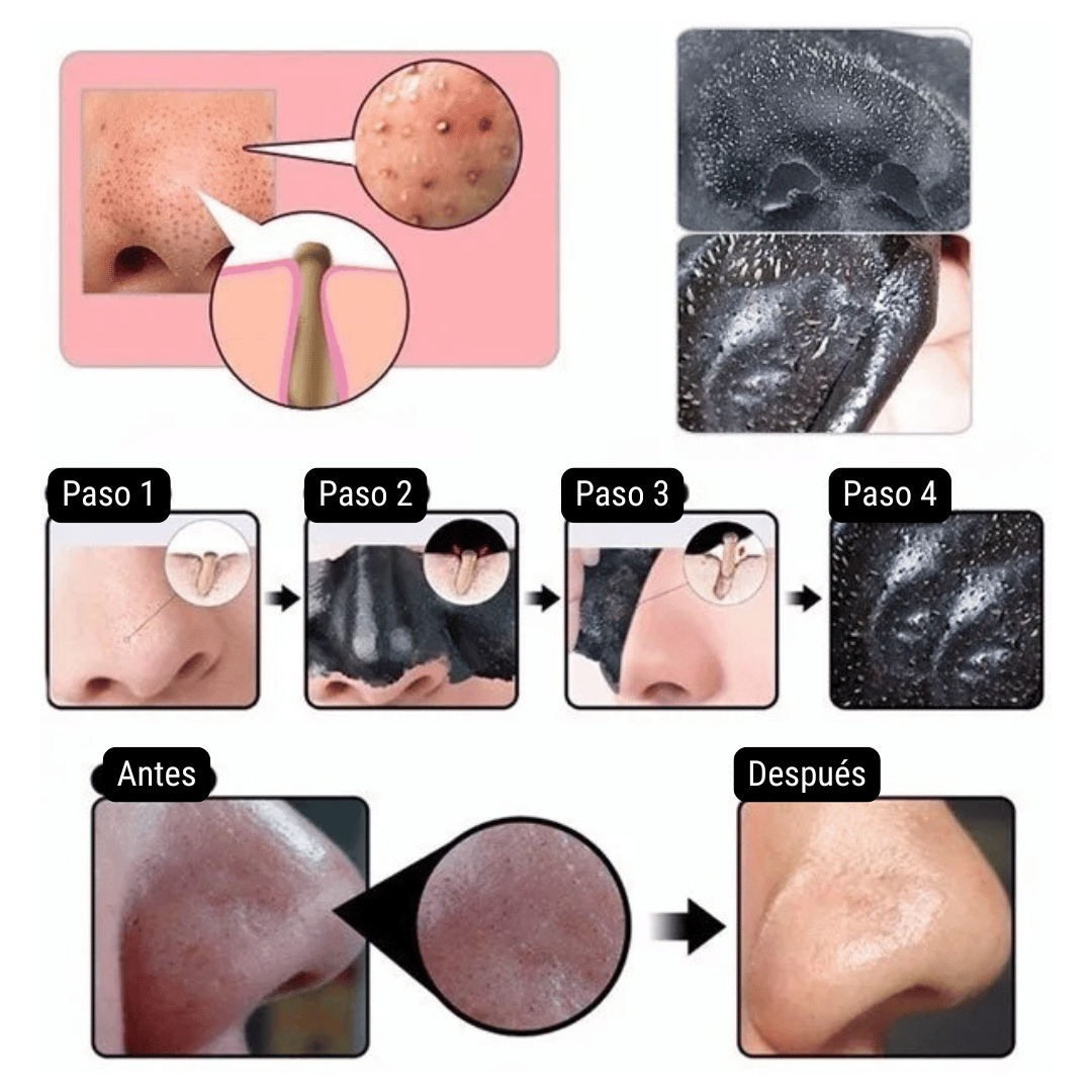 Mascarilla para Puntos Negros