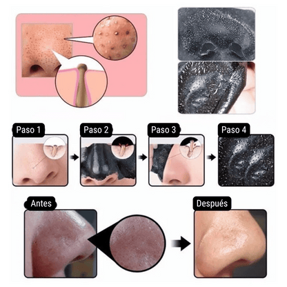 Mascarilla para Puntos Negros